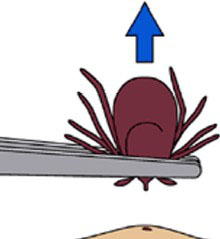 Gently remove tick